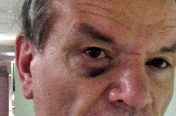 close up of the shiner