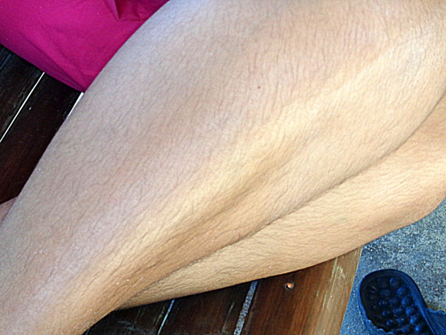 balut can cause hairy legs in females